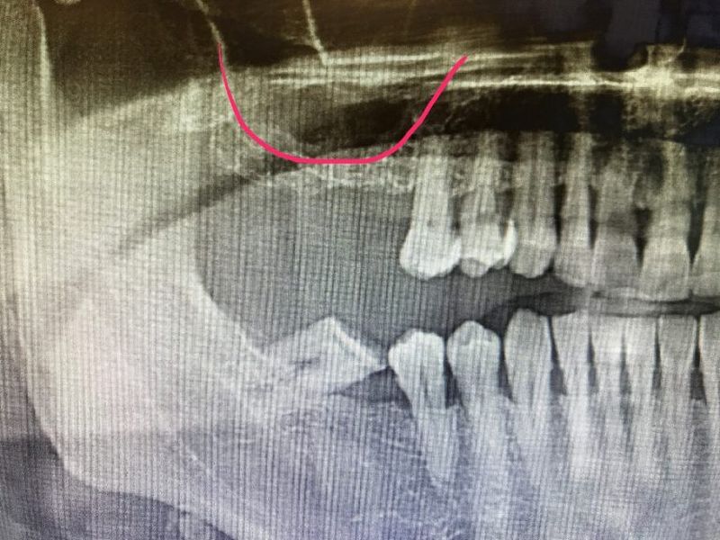 Before Treatment Pictures